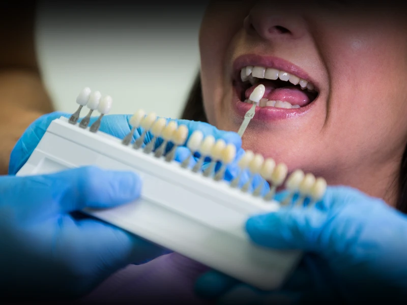 Dental Implants